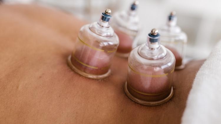 cupping-therapy.jpg