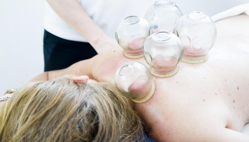cupping-therapy-66042171280.jpg